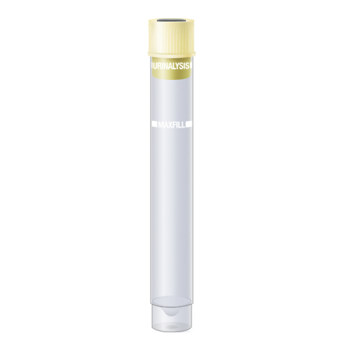 Urine Urinalysis Tube - Yellow